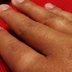 Thumbnail of related posts 113