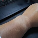 Thumbnail of related posts 109