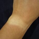 Thumbnail of related posts 125