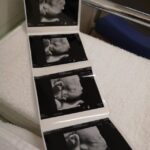 Thumbnail of related posts 046