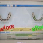 Thumbnail of post image 097